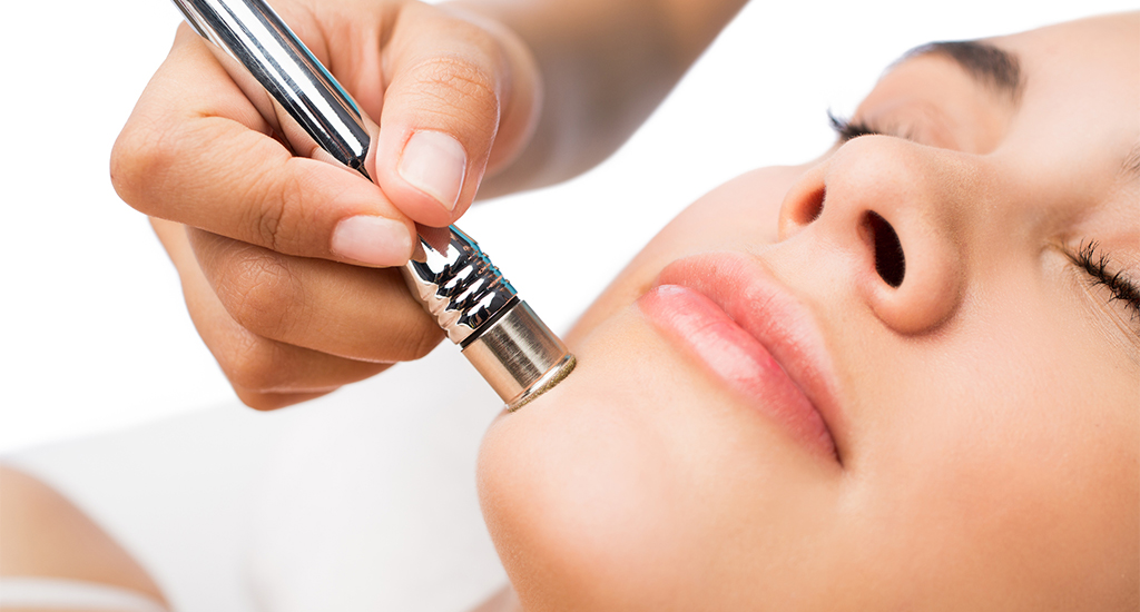 Microdermabrasion Microdermabrasion