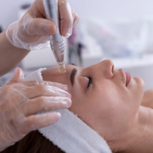 Microneedling Microneedling