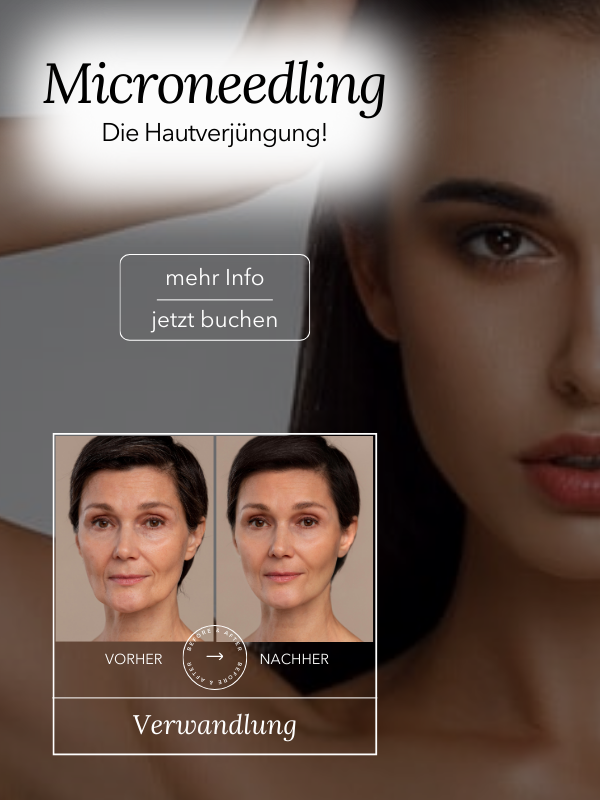 Microneedling Vorher- Nachher- Foto